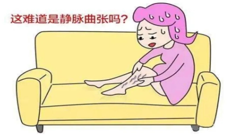 大众科普|你了解下肢静脉曲张吗? 大众科普|你了解下肢静脉曲张吗?