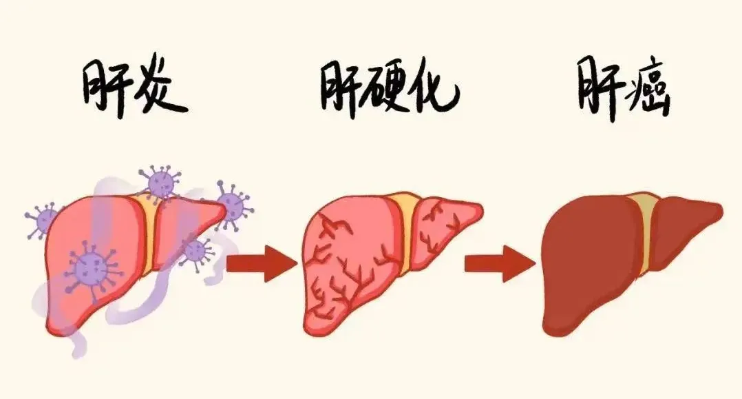大众科普|早癌筛查知多少? 大众科普|早癌筛查知多少?