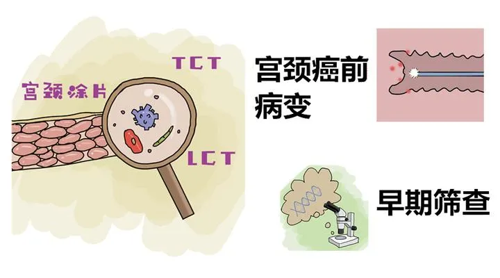 大众科普|早癌筛查知多少? 大众科普|早癌筛查知多少?