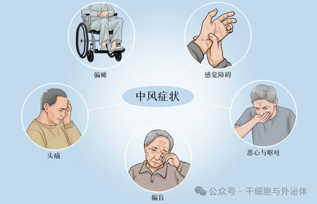 全球14项临床证明,间充质干细胞可有效减少中风后的致残率 全球14项临床证明,间充质干细胞可有效减少中风后的致残率