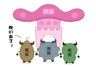大众科普|女性朋友的难言之隐—阴道炎 大众科普|女性朋友的难言之隐—阴道炎