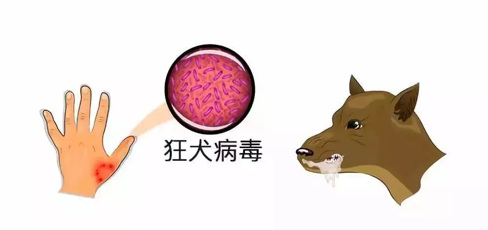 大众科普|被狗咬伤后不容忽视,需这样处置 大众科普|被狗咬伤后不容忽视,需这样处置