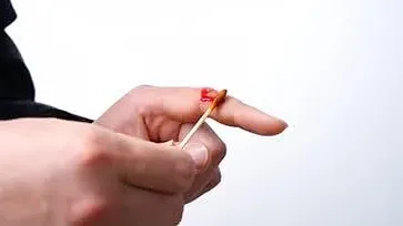 大众科普|被狗咬伤后不容忽视,需这样处置 大众科普|被狗咬伤后不容忽视,需这样处置