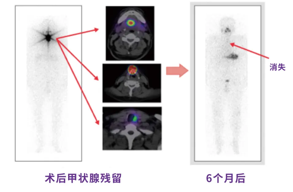  带您一起走进“神秘的核医学科”
