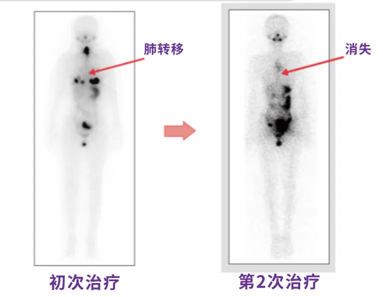  带您一起走进“神秘的核医学科”