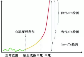 又有新技术？高敏肌钙蛋白技术再再再升级！