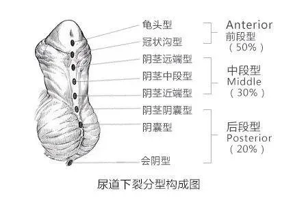 大众科普|又到“包皮季”,男童包皮割还是不割? 大众科普|又到“包皮季”,男童包皮割还是不割?