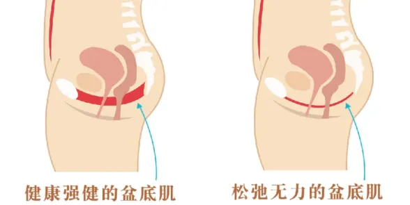 关爱女性,乐享健康 --- 妇科盆底修复 关爱女性,乐享健康 --- 妇科盆底修复