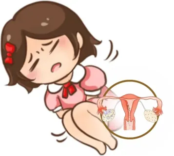 大众科普|关爱自己,拒绝“姨妈痛” 大众科普|关爱自己,拒绝“姨妈痛”
