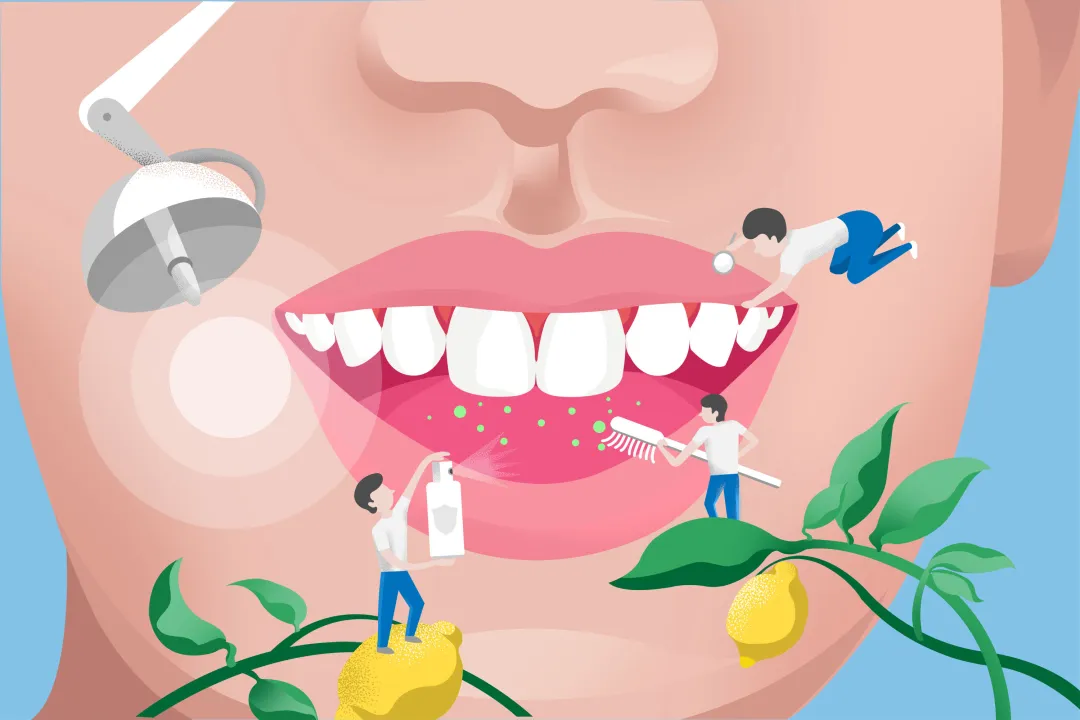 大众科普|可防可治的口腔癌,您了解多少? 大众科普|可防可治的口腔癌,您了解多少?