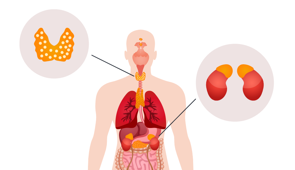 研究发现：慢性肾功能衰竭与甲状腺激素水平的关系