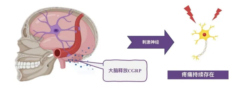 通知公告|我院头痛门诊正式开诊,一站式解决头痛困扰 通知公告|我院头痛门诊正式开诊,一站式解决头痛困扰