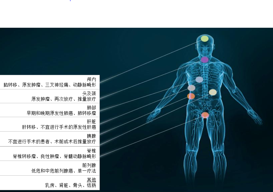 Accuray(安科锐)M6全数字放射外科射波刀 Accuray(安科锐)M6全数字放射外科射波刀
