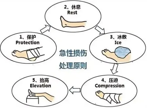 骨科科普|不小心脚崴了?正确处理助你 “站稳脚跟” 骨科科普|不小心脚崴了?正确处理助你 “站稳脚跟”