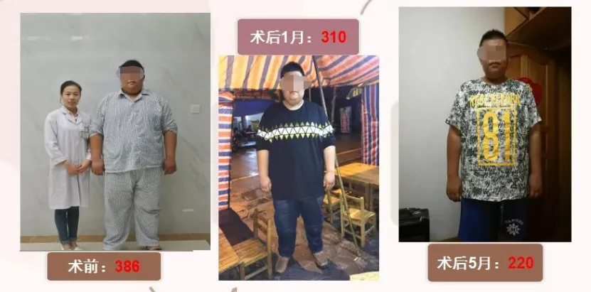 病例分享|帮助肥胖病患重塑健康人生，点亮生命之光