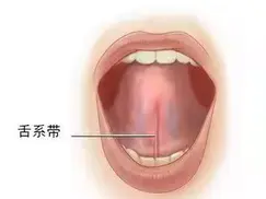 【育聪】如何矫正孩子吐字不清问题？