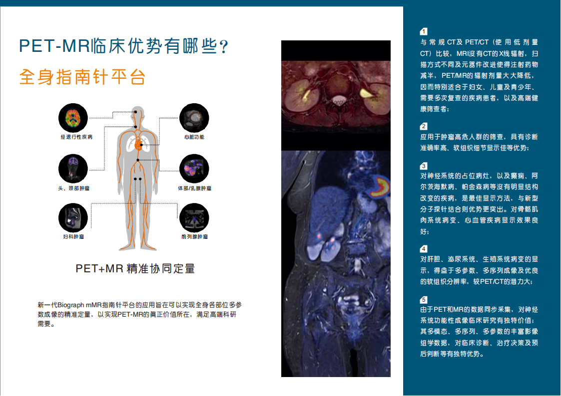 核医学部PET/MR