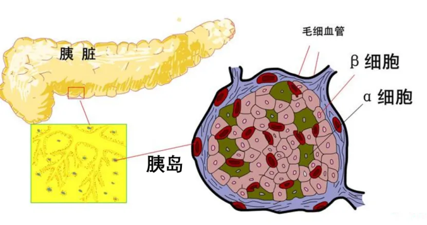 大众科普|糖尿病告别终身服药! 用“2T疗法”唤醒胰岛细胞,血糖稳稳降下来! 大众科普|糖尿病告别终身服药! 用“2T疗法”唤醒胰岛细胞,血糖稳稳降下来!