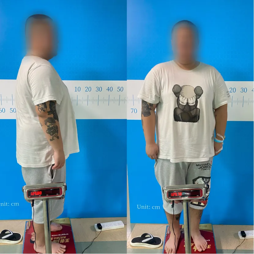 病例分享|从“负重前行”到“轻盈新生”:一场手术如何改写他的人生? 病例分享|从“负重前行”到“轻盈新生”:一场手术如何改写他的人生?