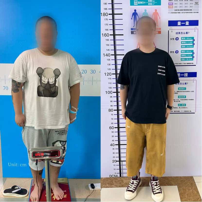 病例分享|从“负重前行”到“轻盈新生”:一场手术如何改写他的人生? 病例分享|从“负重前行”到“轻盈新生”:一场手术如何改写他的人生?