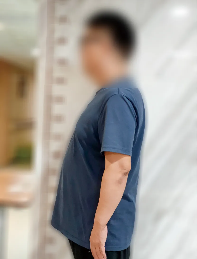 病例分享|空腹血糖从16.81降到5.2，停用胰岛素，停所有降糖药，李大哥只做对一件事！